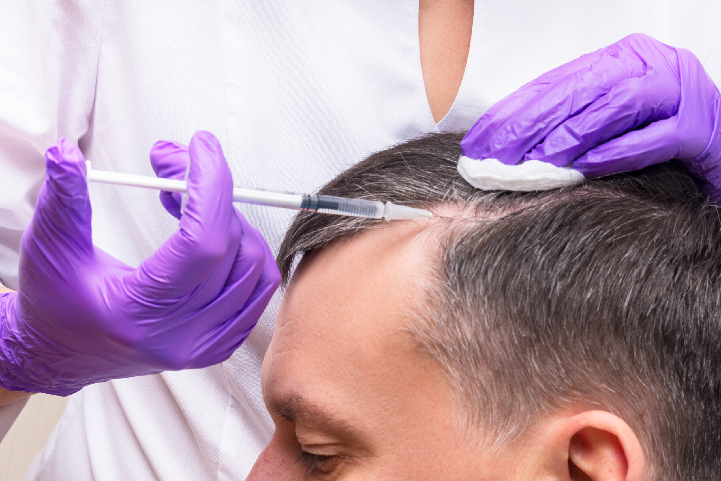 Hair and scalp regeneration treatment